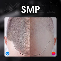 Mast Digital Scalp Mikropigmentacja Zestaw SMP