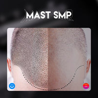 Mast SMP Scalp Micropigmentation Set